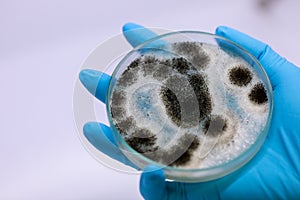 Aspergillus mold for Microbiology in Lab.
