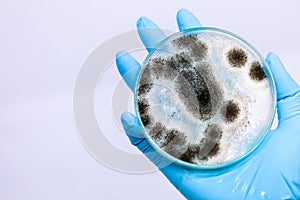 Aspergillus mold for Microbiology in Lab.