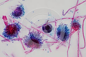 Aspergillus mold under the light microscopic view photo