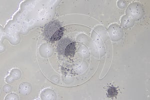 Aspergillus mold and yeast for Microbiology.