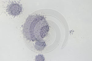 Aspergillus mold and yeast for Microbiology.