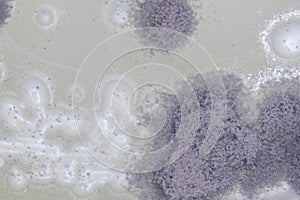 Aspergillus mold and yeast for Microbiology.