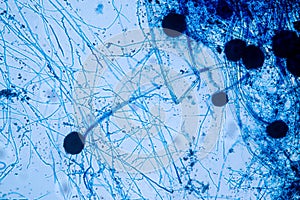 Aspergillus niger and Aspergillus oryzae  mold under microscope.