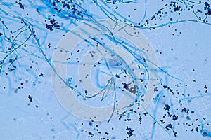 Aspergillus niger and Aspergillus oryzae  mold under microscope.