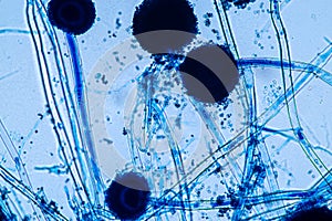 Aspergillus niger and Aspergillus oryzae  mold under microscope.