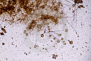 Aspergillus niger and Aspergillus oryzae  mold under microscope.