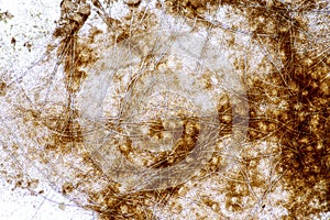 A schimmel Mikroskop 