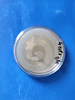 Aspergillus niger and Bacillus genus bacteria on saboraud dextrose agar medium