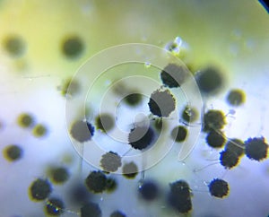 Aspergillus niger the black mold conidia under the microscope