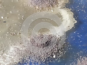 Aspergillus niger fungus  and  bacteria growing on sabouraud dextrose agar medium