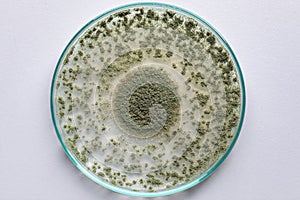 Aspergillus oryzae is a filamentous fungus or mold that is used in food production such as in soybean fermentation . photo