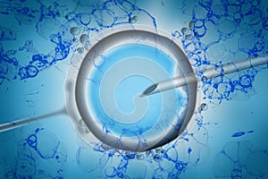 Assisted reproductive technology in fertility treatment