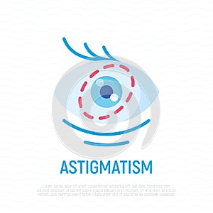 Astigmatism flat icon. Ophthalmology