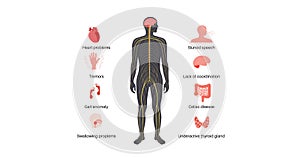 Ataxia cerebellar disorder photo