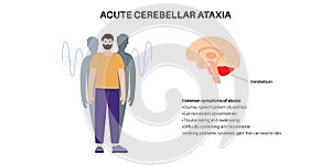 Ataxia cerebellar disorder photo