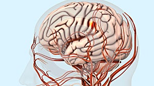 Atherosclerotic cardiovascular disease and stroke