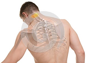 Atlas C1, C2 Spine Anatomy isolated on white photo