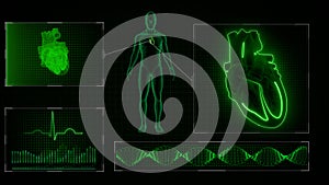 AV Node Signal or Atrioventricular Node Signal of Human Heart photo