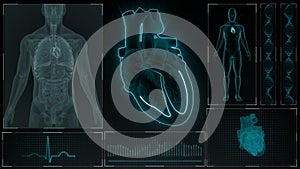 AV Node Signal or Atrioventricular Node Signal of Human Heart photo