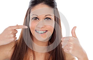 Attractive young woman with brackets saying Ok photo