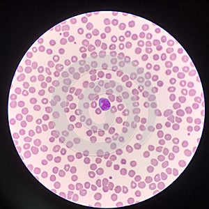 Atypical lymphocyte on red blood cells background photo