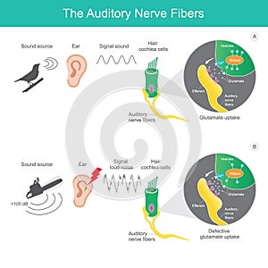 The auditory nerve fibres, comparison sound source 2 types which it is sent the signal sound