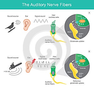 The auditory nerve fibres, comparison sound source 2 types which it is sent the signal sound photo
