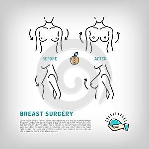Augmentation Breast plastic surgery logos Silicone implants Vector icons