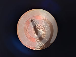 Aureobasidium pullulans under the microscope