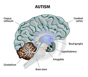 Autism