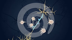 Autoimmune Attack on Myelin Sheath