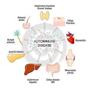 Autoimmune disease