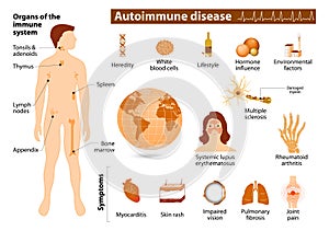 Autoimmune disease infographic