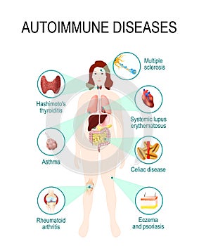 Autoimmune diseases photo