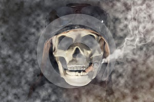 Aviator Skull