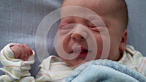 Awake Newborn Baby Face Portrait Acne Allergic Irritations Early Days Grimace On Blue Background. Child Start Minutes Of