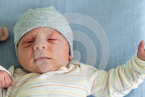 Awake Newborn Baby Face Portrait Acne Allergic Irritations Early Days Grimace Crying On Blue Background. Child Start