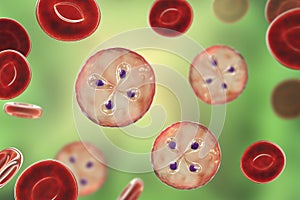 Babesia parasites inside red blood cell, the causative agent of babesiosis