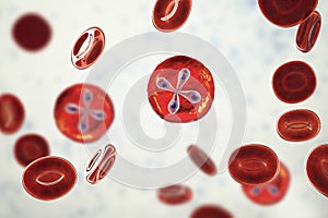 Babesia parasites inside red blood cell, the causative agent of babesiosis