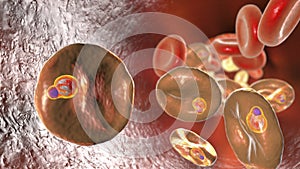 Babesia parasites inside red blood cell, the causative agent of babesiosis