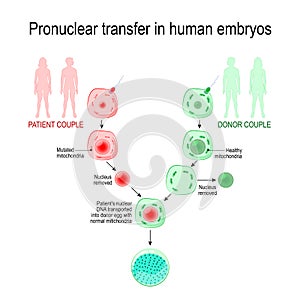 babies of three-parent. inherited mitochondrial diseases. Pronuclear transfer in human embryos. photo