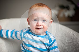 Baby boy with atopic dermatitis