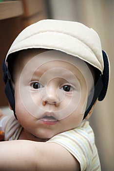 Baby boy in a protective helmet.