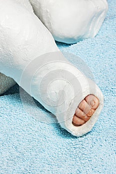 Baby boy's leg with plaster bandage