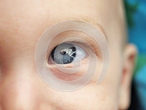 Baby eye