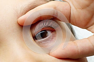 Baby eye pupil iris opened two finger