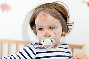 Face bruises and scratches