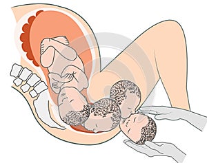 Baby Fetus in Pregnant Woman`s belly medical illustration