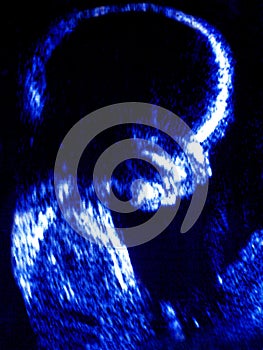 Baby Fetus Ultrasound Scan