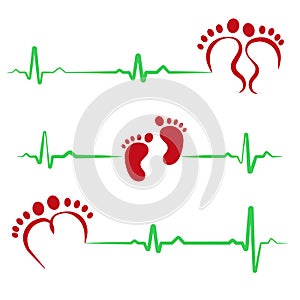 Baby footprint flat icon isolated on white background. Baby heartbeat. Child's sonogram. Design elements for nursery photo